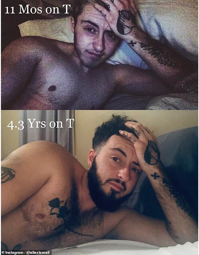 US de-transitioner who had her breasts removed as a teen is having boob job to reclaim her femininity as she warns other�trans�girls