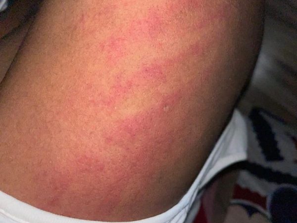 I Just Gave Birth To Twins Through CS And My Husband Has Beaten Me Twice