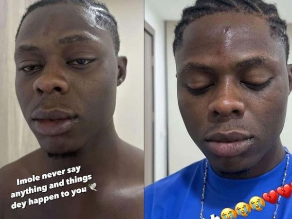 Photos Of Late Singer, Mohbad With Injuries On His Face After Alleged Assaults Surface Online