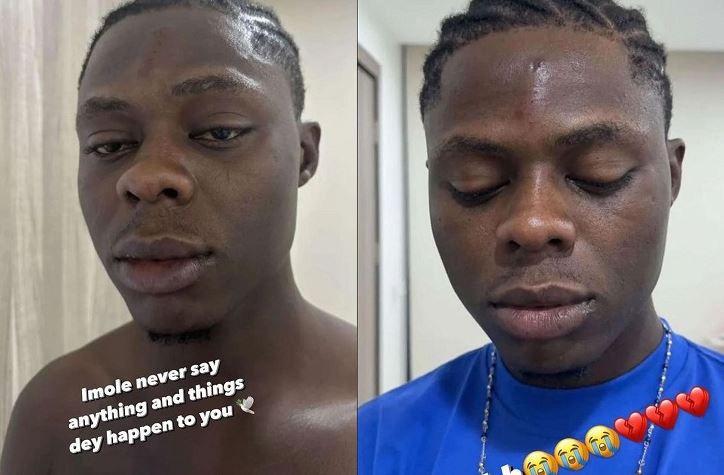 Photos Of Late Singer, Mohbad With Injuries On His Face After Alleged Assaults Surface Online