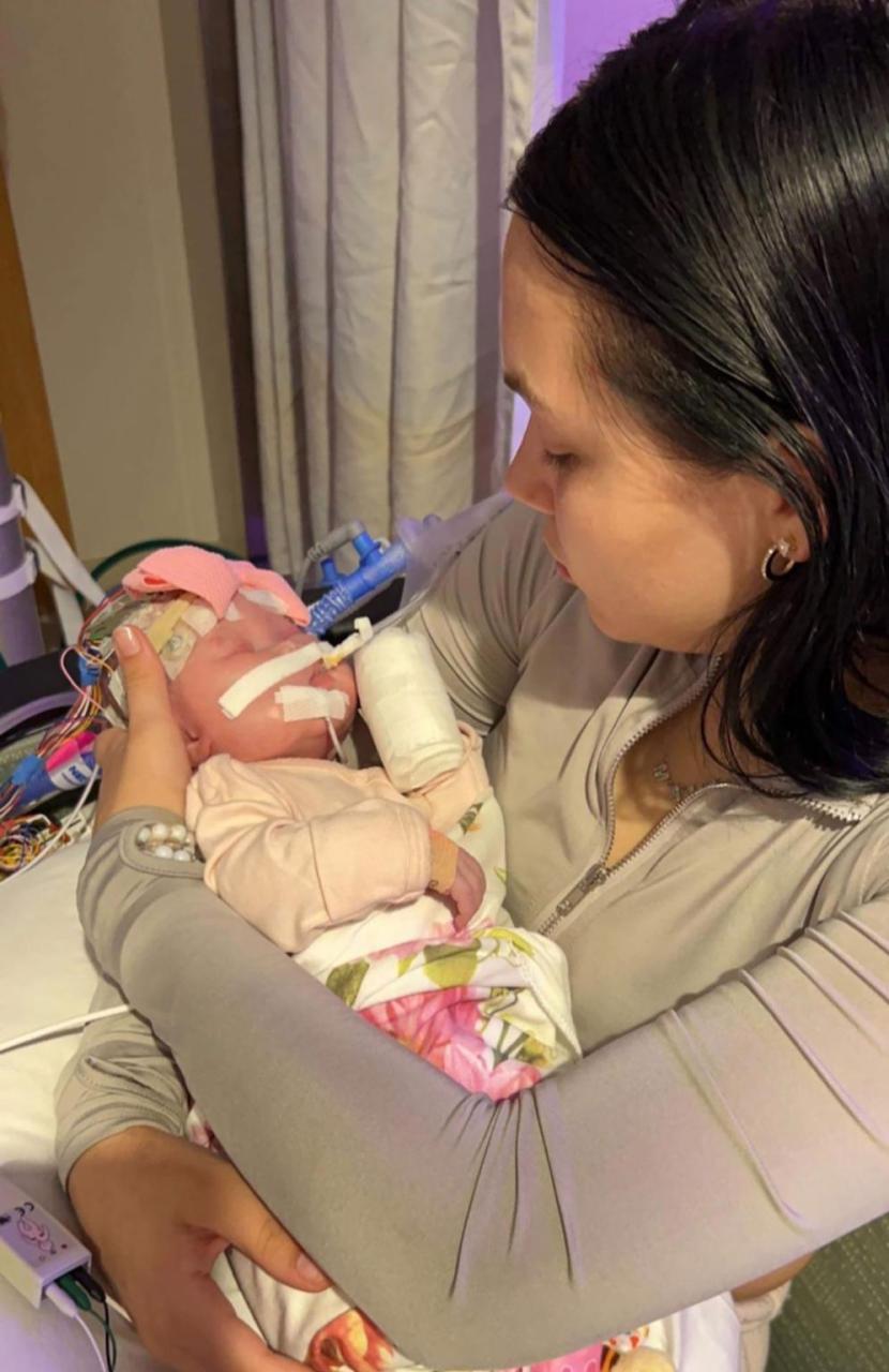 Doctors surprised that "Miracle" Baby born without eyes and had half her brain removed is 
