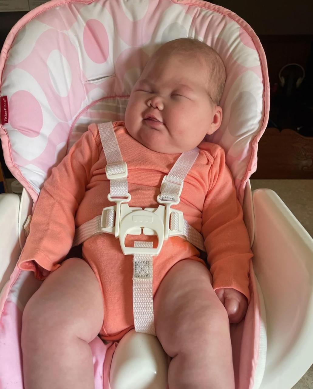 Doctors surprised that "Miracle" Baby born without eyes and had half her brain removed is 