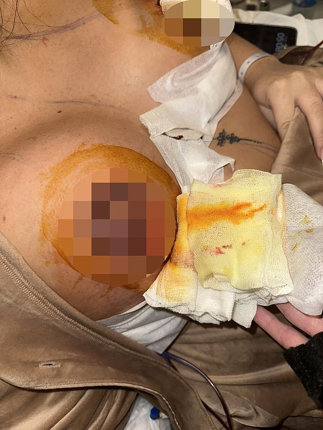 22-year-old woman left with