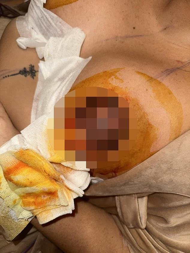 22-year-old woman left with