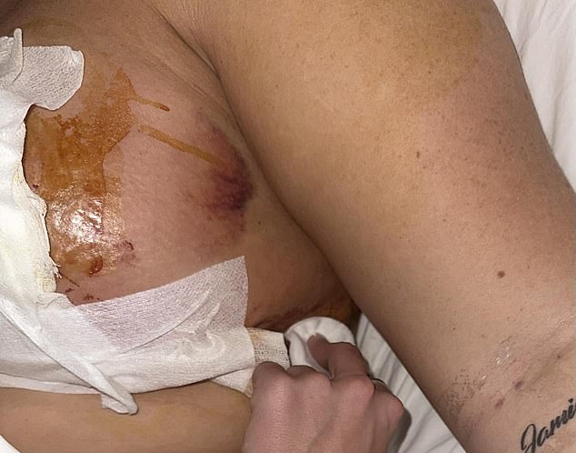 22-year-old woman left with