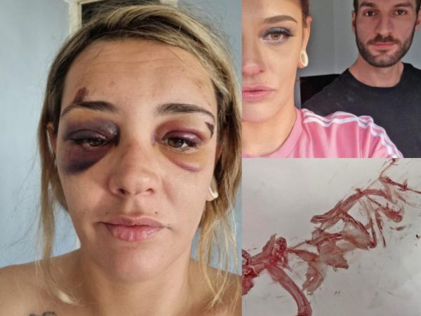 Brave mum wrote abusive boyfriends name on the wall with her own blood so police can catch him if she d!es