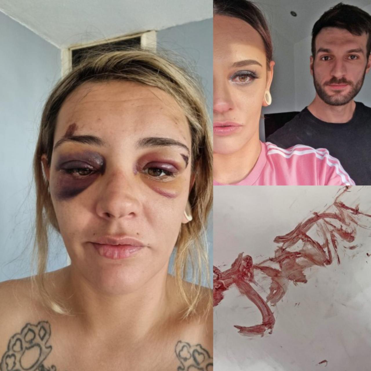 Brave mum wrote abusive boyfriends name on the wall with her own blood so police can catch him if she d!es