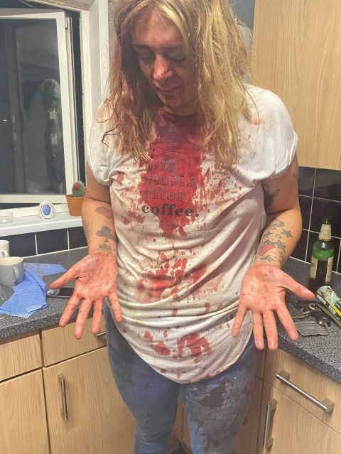 Brave mum wrote abusive boyfriends name on the wall with her own blood so police can catch him if she d!es