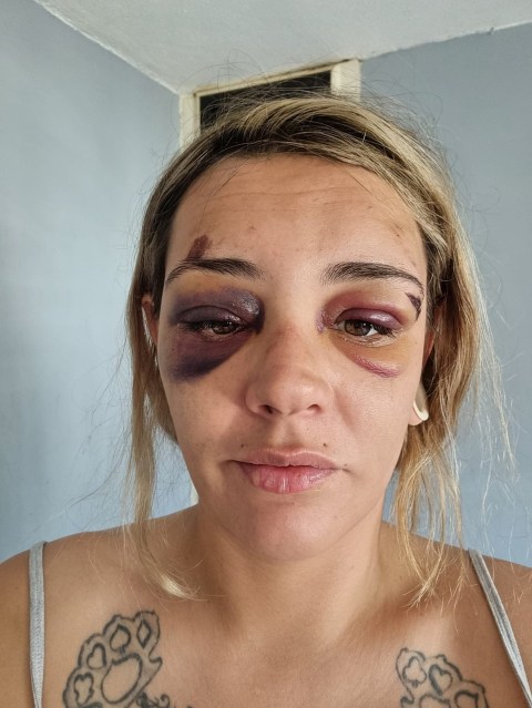 Brave mum wrote abusive boyfriends name on the wall with her own blood so police can catch him if she d!es