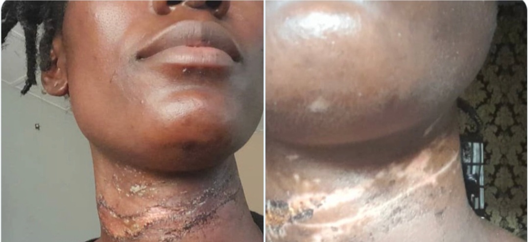 Nigerian doctor cries out for help after a junior doctor who was almost killed in a attack, was forced back to work by her boss