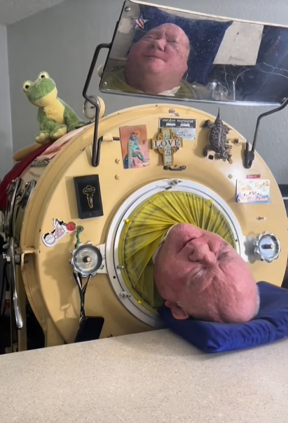 Iron lung man, Paul alexander, dies at 78 after spending 70 years living inside iron tank