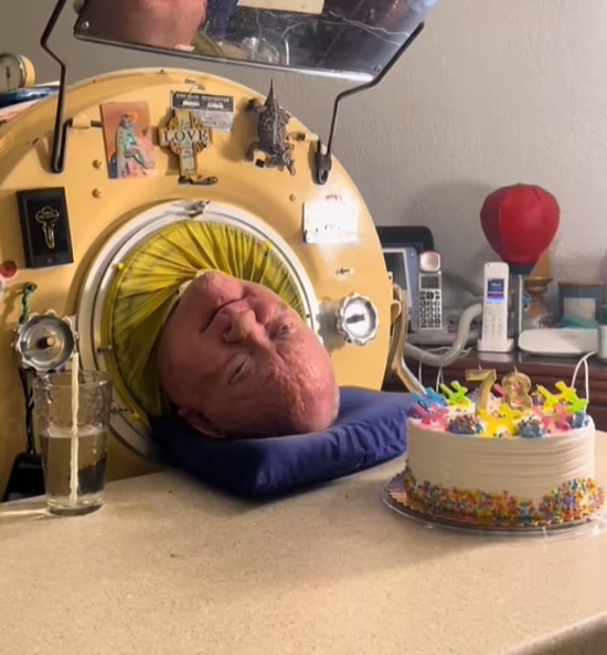 Iron lung man, Paul alexander, dies at 78 after spending 70 years living inside iron tank