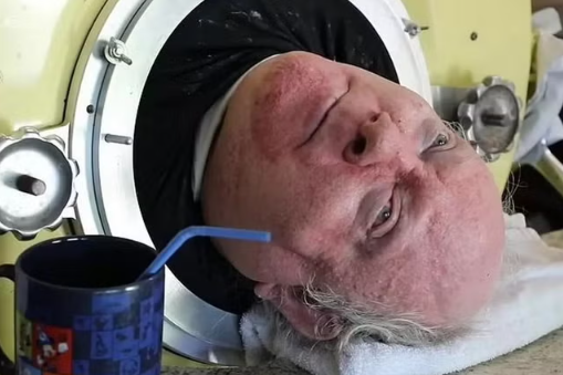 Iron lung man, Paul alexander, dies at 78 after spending 70 years living inside iron tank