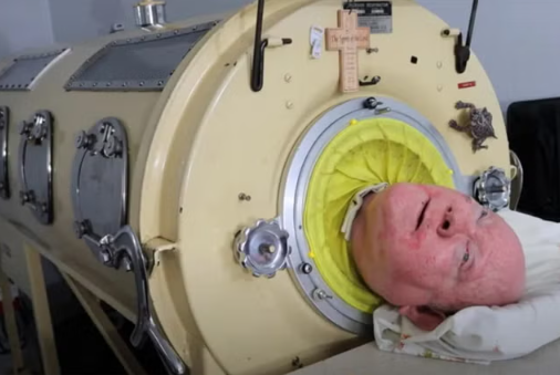 Iron lung man, Paul alexander, dies at 78 after spending 70 years living inside iron tank