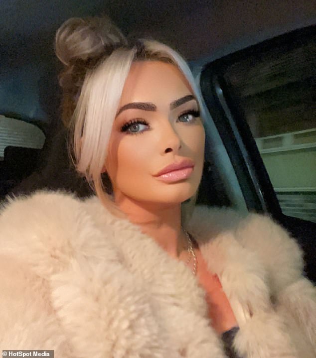 Mother-of-three shares images of her horrific facial injuries after she was attacked by�her�boyfriend