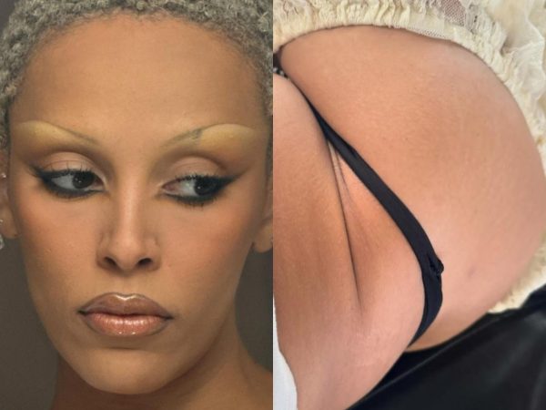 Singer, Doja Cat laments that her BBL has gone out of control