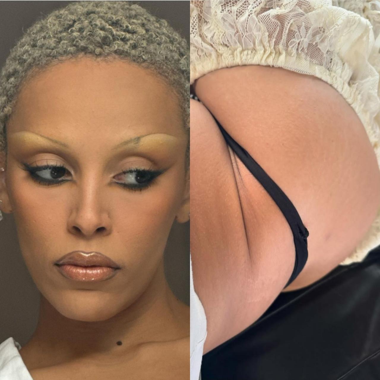 Singer, Doja Cat laments that her BBL has gone out of control
