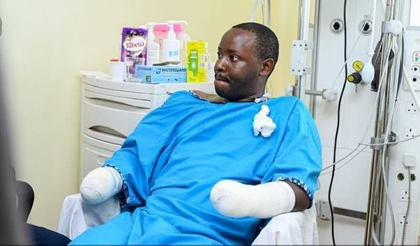 Photos of Police officer who lost both hands after teargas canister detonated on him during protests