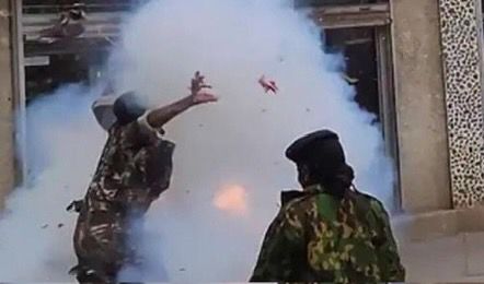 Photos of Police officer who lost both hands after teargas canister detonated on him during protests