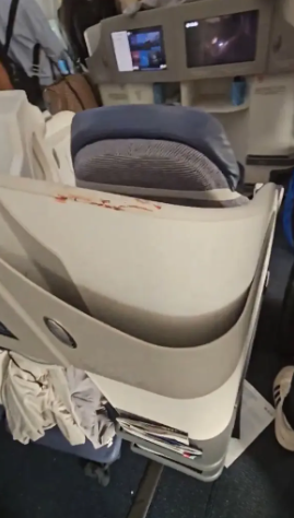 At least 30 injured after Boeing flight hits turbulence, sending passengers flying with one man stuck in the overhead bin (video)