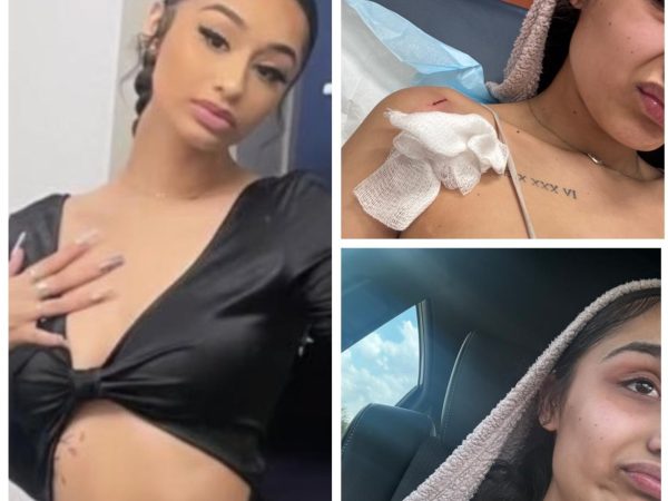 Woman claims man sh0t her after she refused to give him her phone number