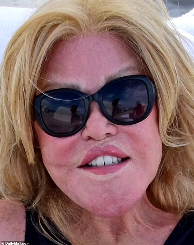 Socialite Jocelyn Wildenstein reveals her real face in photo taken before plastic surgery transformation