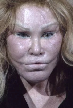 Socialite Jocelyn Wildenstein reveals her real face in photo taken before plastic surgery transformation