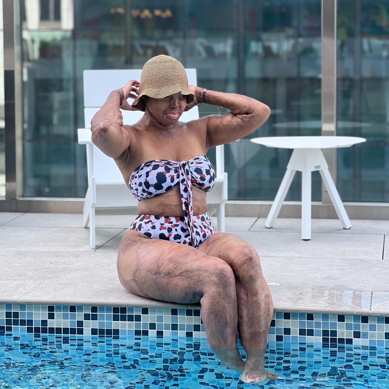 Plane crash survivor, Kechi Okwuchi dons bikini