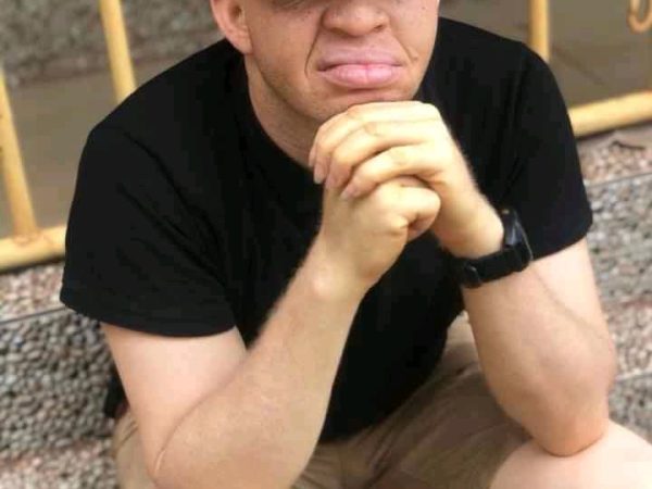 Don’t come near me with that rubbish mentality – Nigerian man warns people who say albinos have Iow self esteem because of their skin color