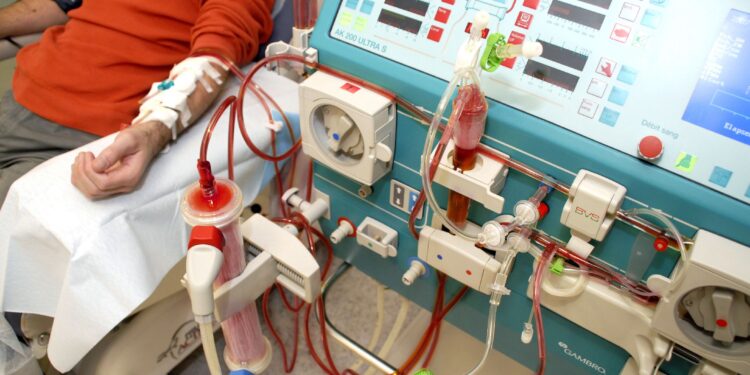 Nigerians with kidney ailments face high dialysis costs as transplant exceeds N14 million 
