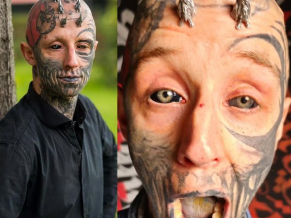Man working on becoming reptilian by getting silicone inserted weekly in his skull